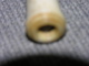 photo - eye end