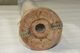 photo - eye end
